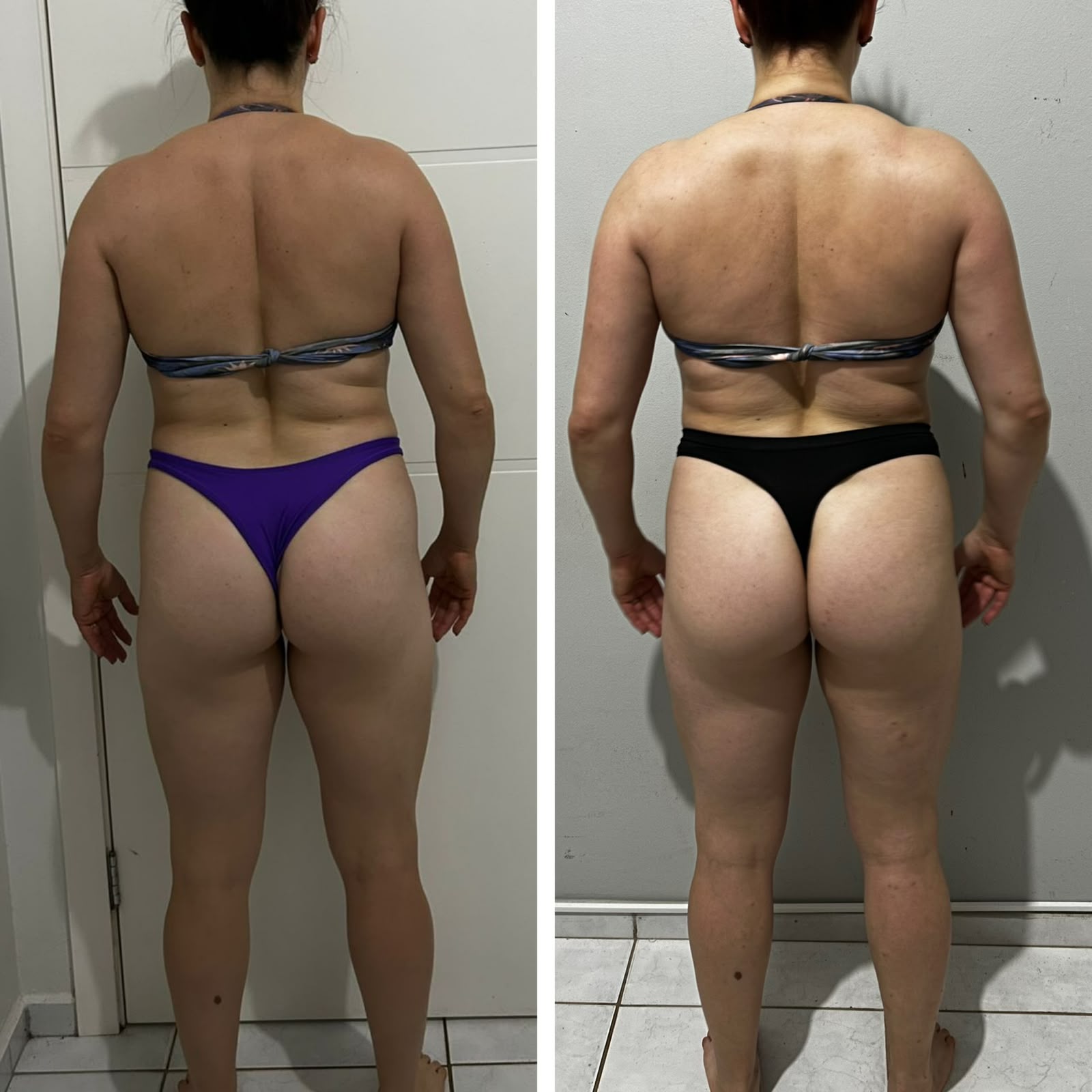 Comparativo antes e depois, vista posterior